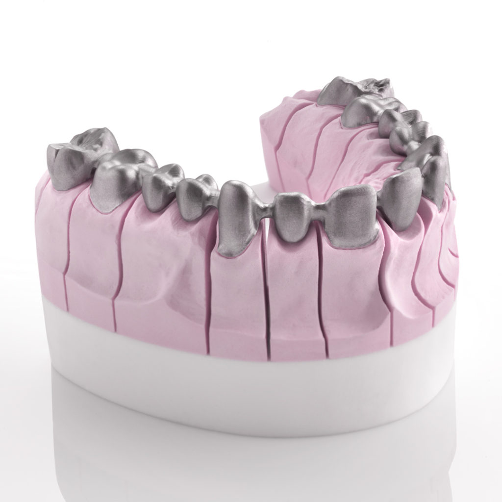 protesis-dental