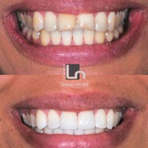 estetica-dental-tratamientos